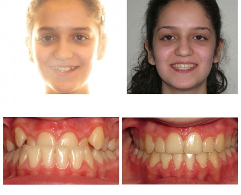 best orthodontist radnor | Faust Orthodontics Havertown Pa