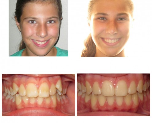 best orthodontist ardmore | Faust Orthodontics Havertown Pa